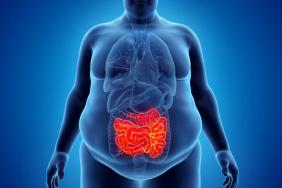 Les protéines intestinales comme nouveaux biomarqueurs des complications de l’obésité